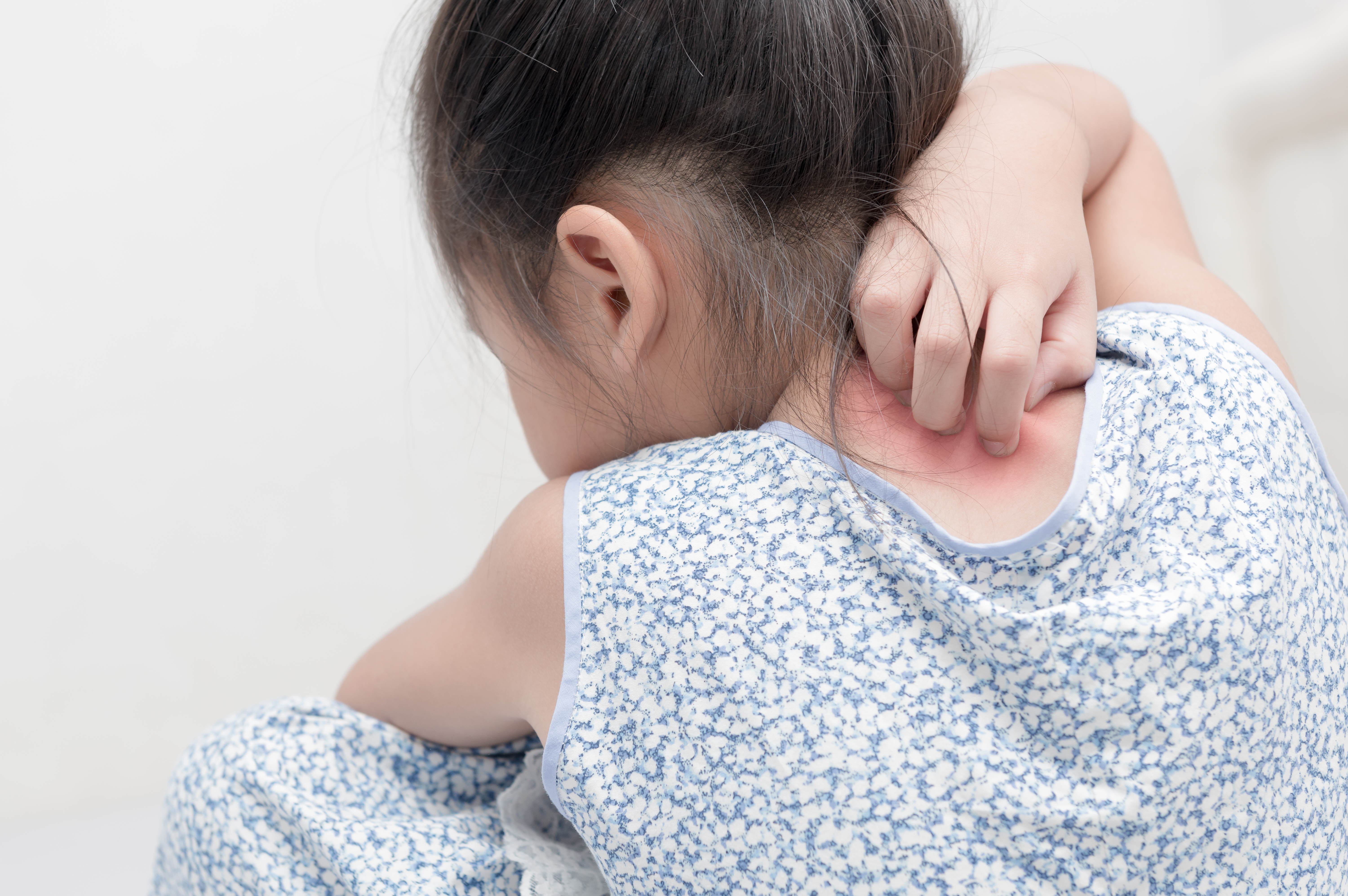 Child scratching the back of her neck: potential heat rash symptoms